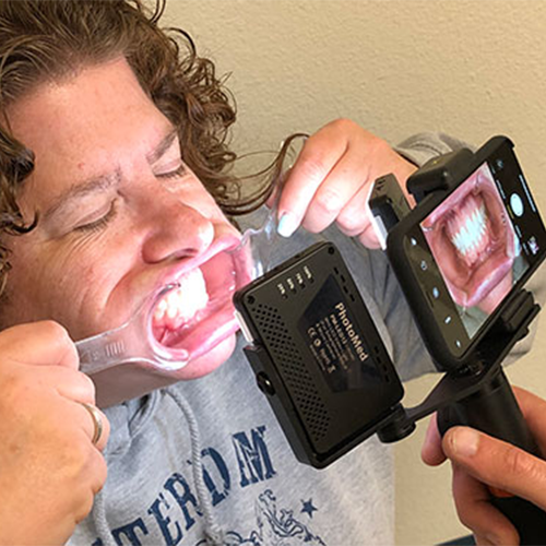 Photomed Dental LED Light for Smartphone